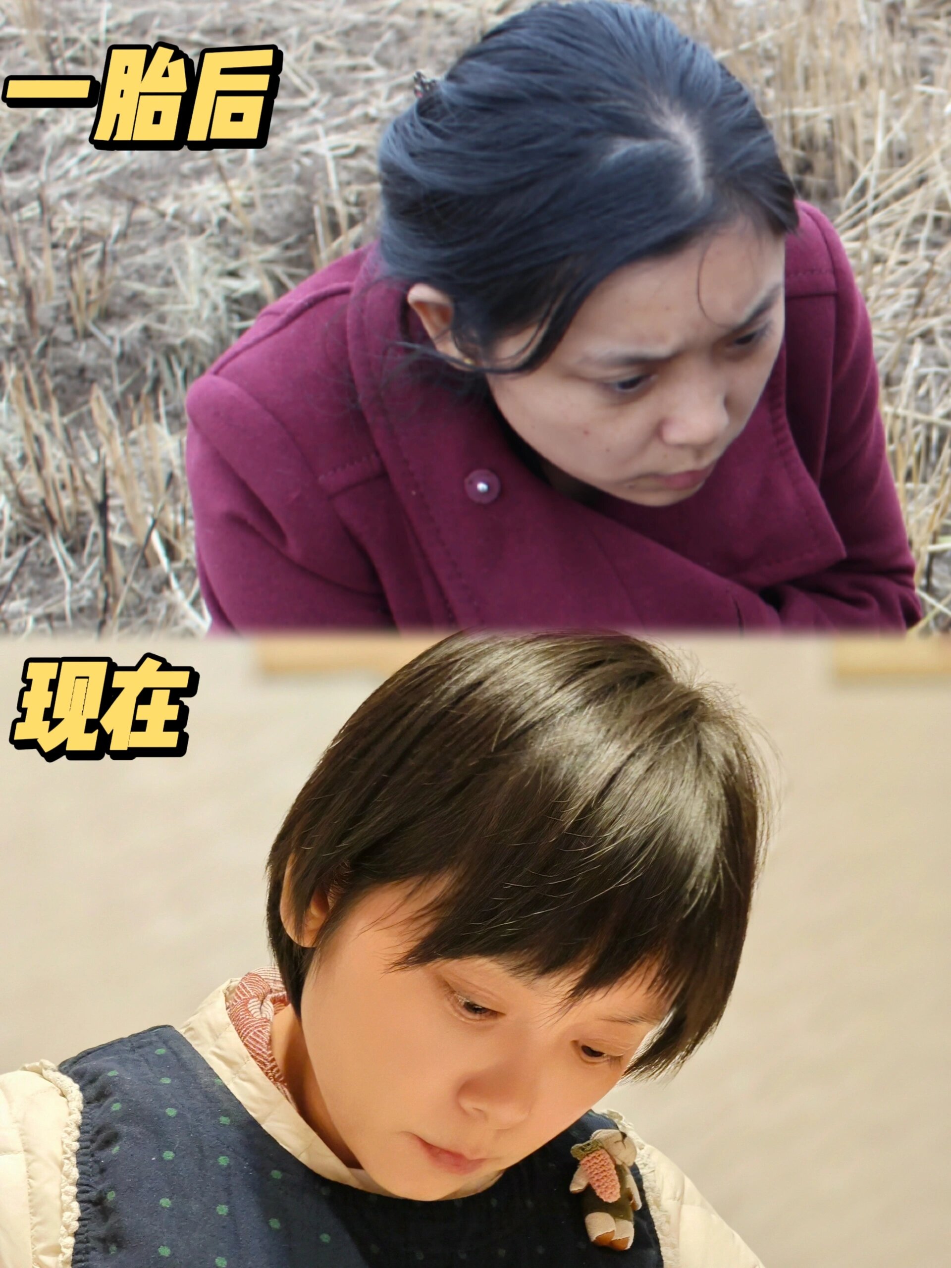 关于年纪越大,头发越多这件事