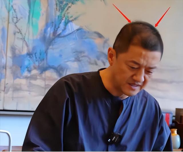 这6位男神中年秃顶,从郑少秋到黄晓明,个个发际线高到离谱!