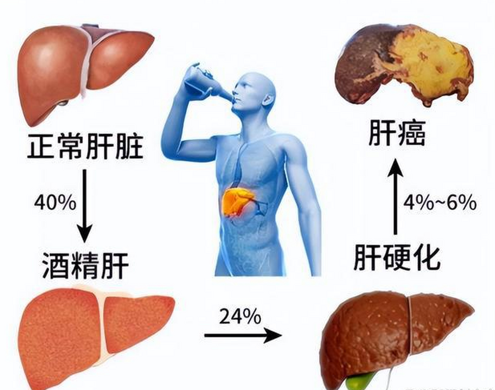 槟榔肝肝脏图片