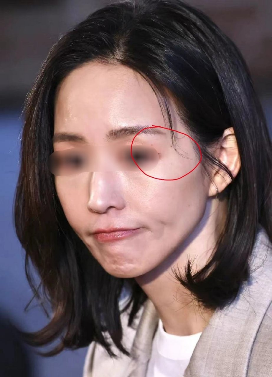 眉尾三角区为夫妻宫 三颗痣,感情方面要想开. 对应流年34,36,38岁.