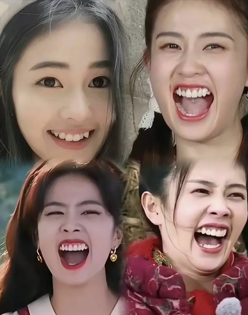 看完我终于知道为什么这么多女明星都整牙了,虽然没整前就挺好看的,但