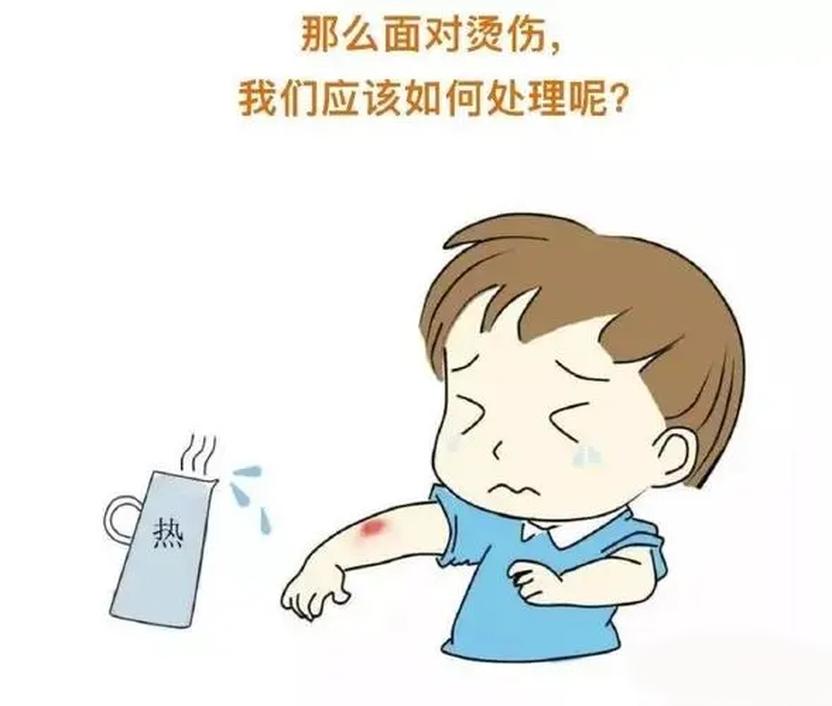 孩子烧烫伤怎么办?三步让你成为孩子的守护天使