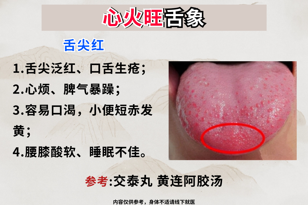 舌尖红心火旺,舌边红肝火旺,舌中红胃火旺,中医教你如何调理#中医