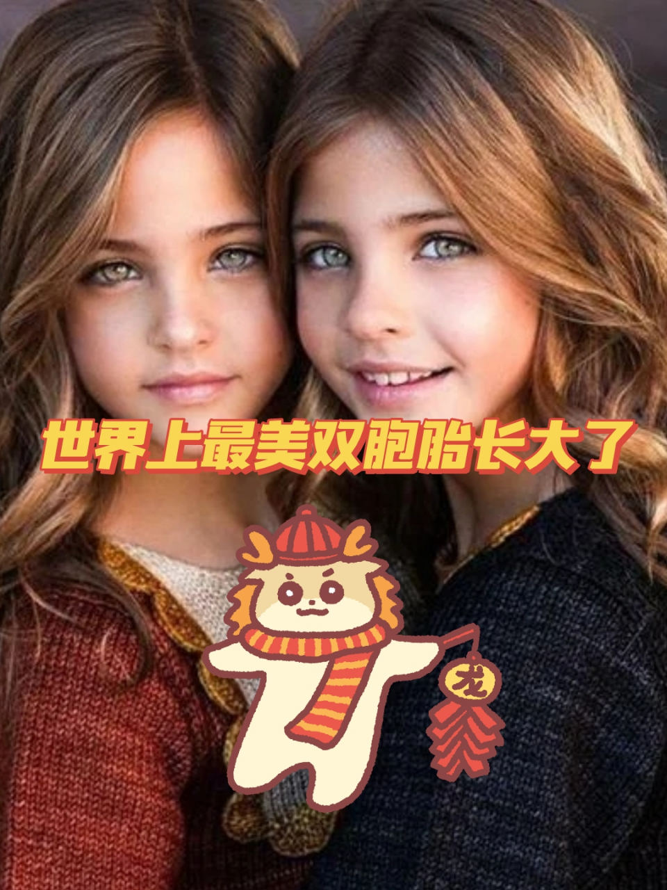 世界上最美双胞胎长大了 美国加利福尼亚州一对双胞胎莉亚·罗斯和