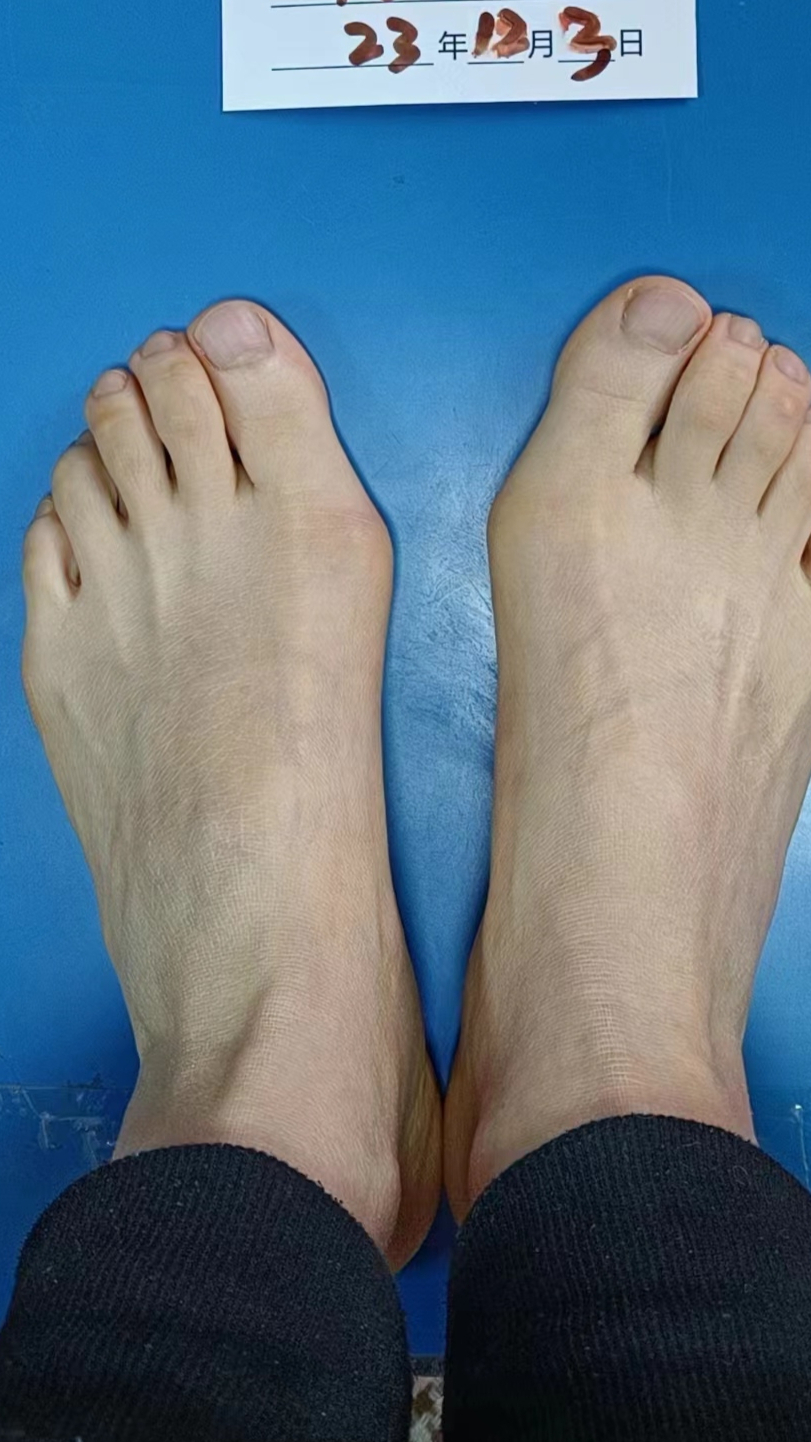 大脚骨也许会带来一些