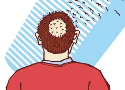 解锁脱发之谜:细数那些你可能忽视的症状