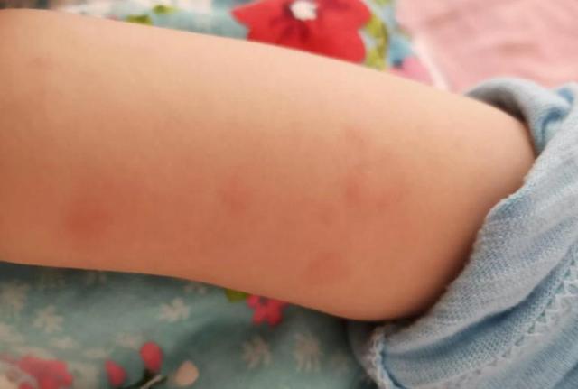 螨虫最大的天敌并不是暴晒教你1个土法子螨虫全都消失