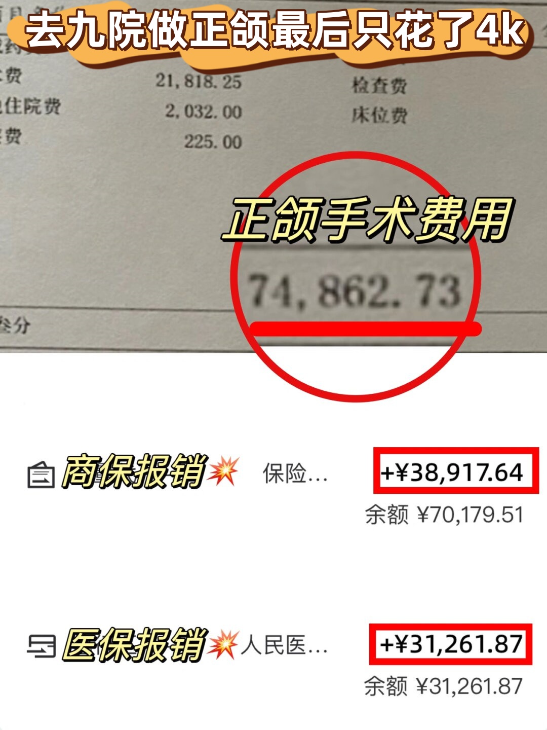 关于广州佛山医院vip可以医保吗多少钱一个月的信息