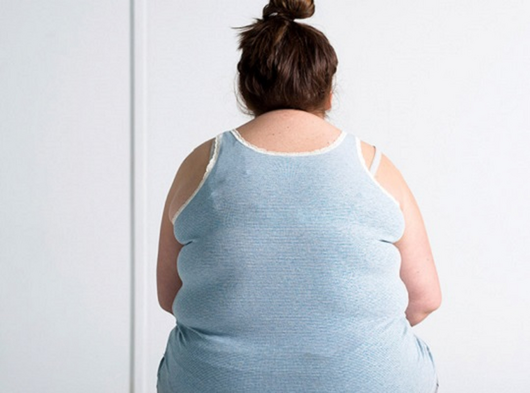 陶女士,女32岁,肥胖4年,患者因生育后因饮食未加控制,体重明显增加