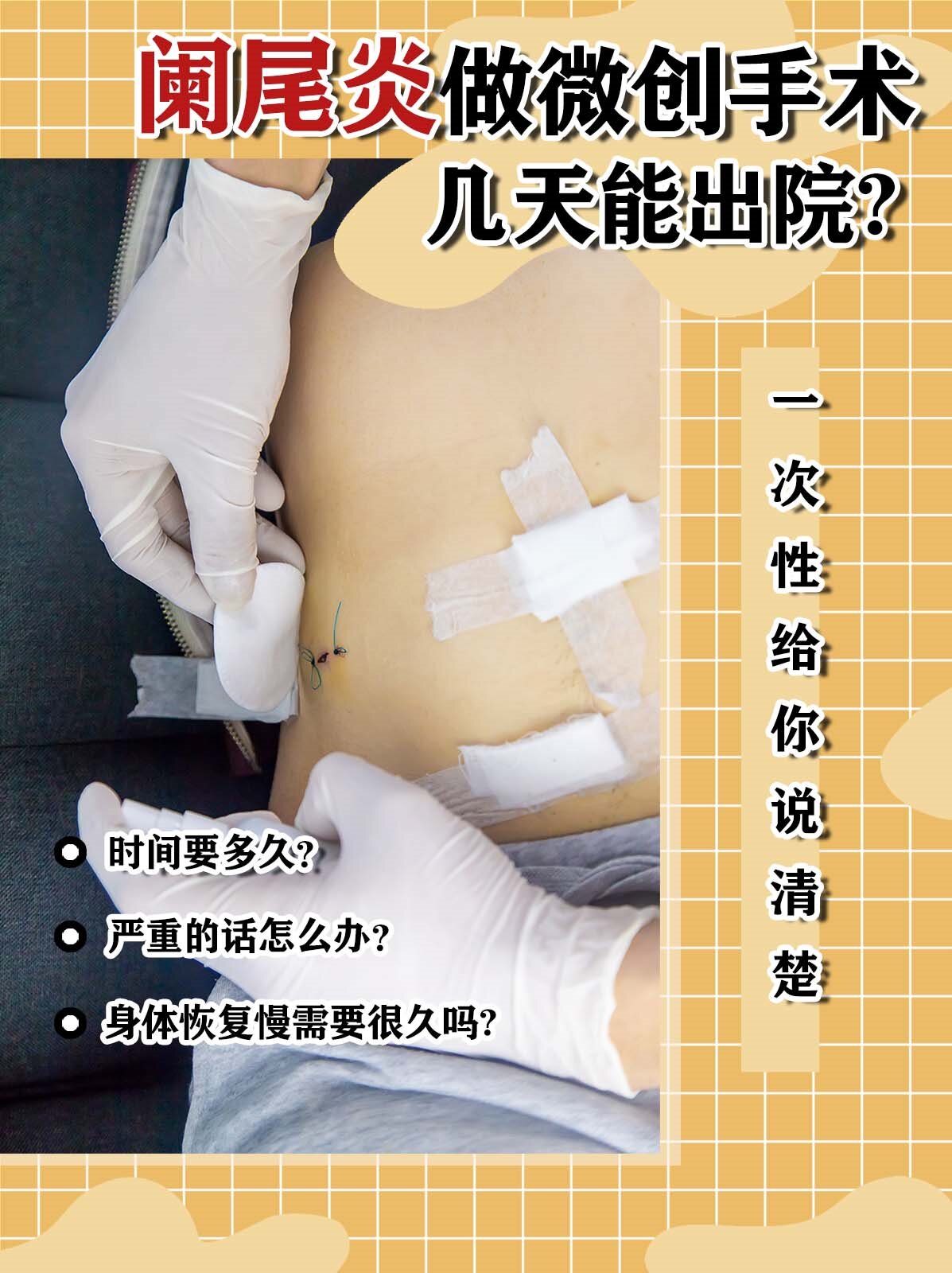 一次性给你说清楚】 大家都知道得了阑尾炎要尽早做手术病情拖得越