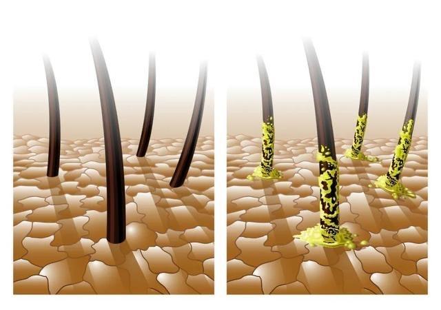 自然生发的新希望:深圳永保健康智慧生发