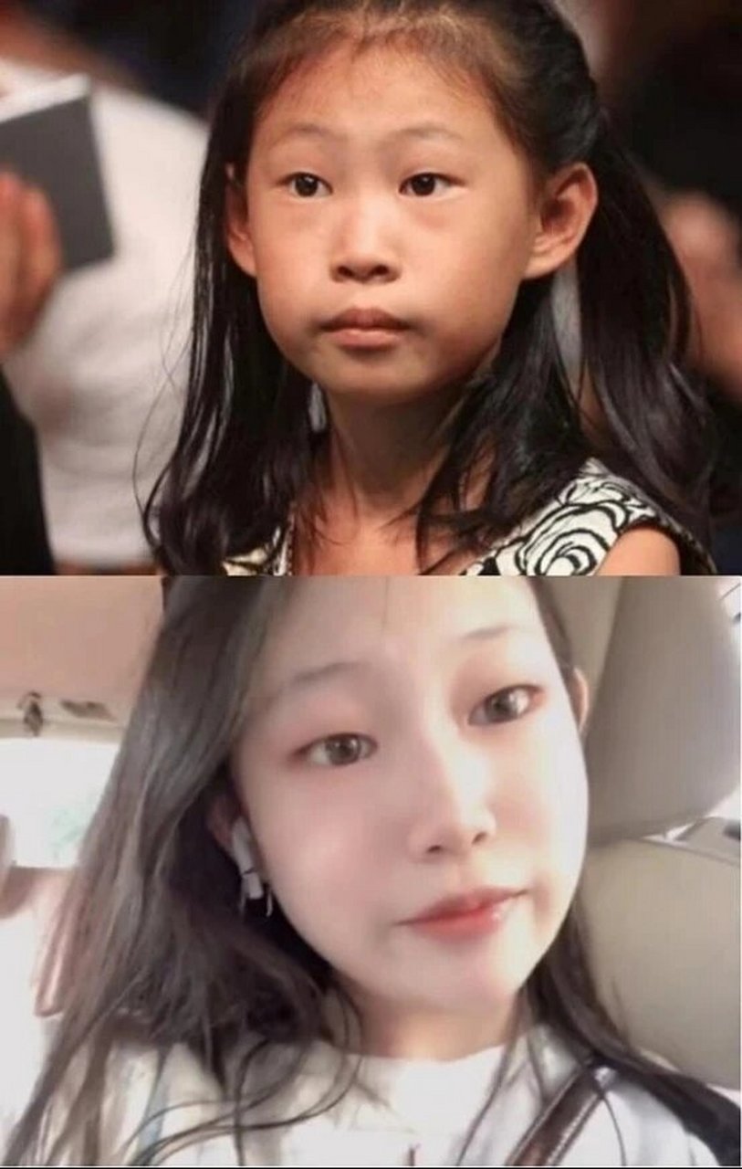 小沈阳女儿,丑小鸭变成白天鹅. 当年被骂丑的小女孩现在变美了.