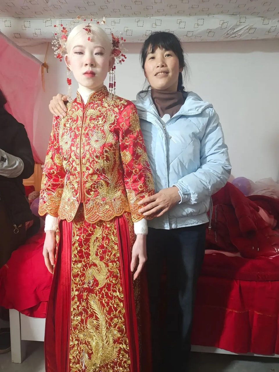 表妹自小先天性白化病,一直没能找到合适的婆家,毕竟谁也不想找个得病