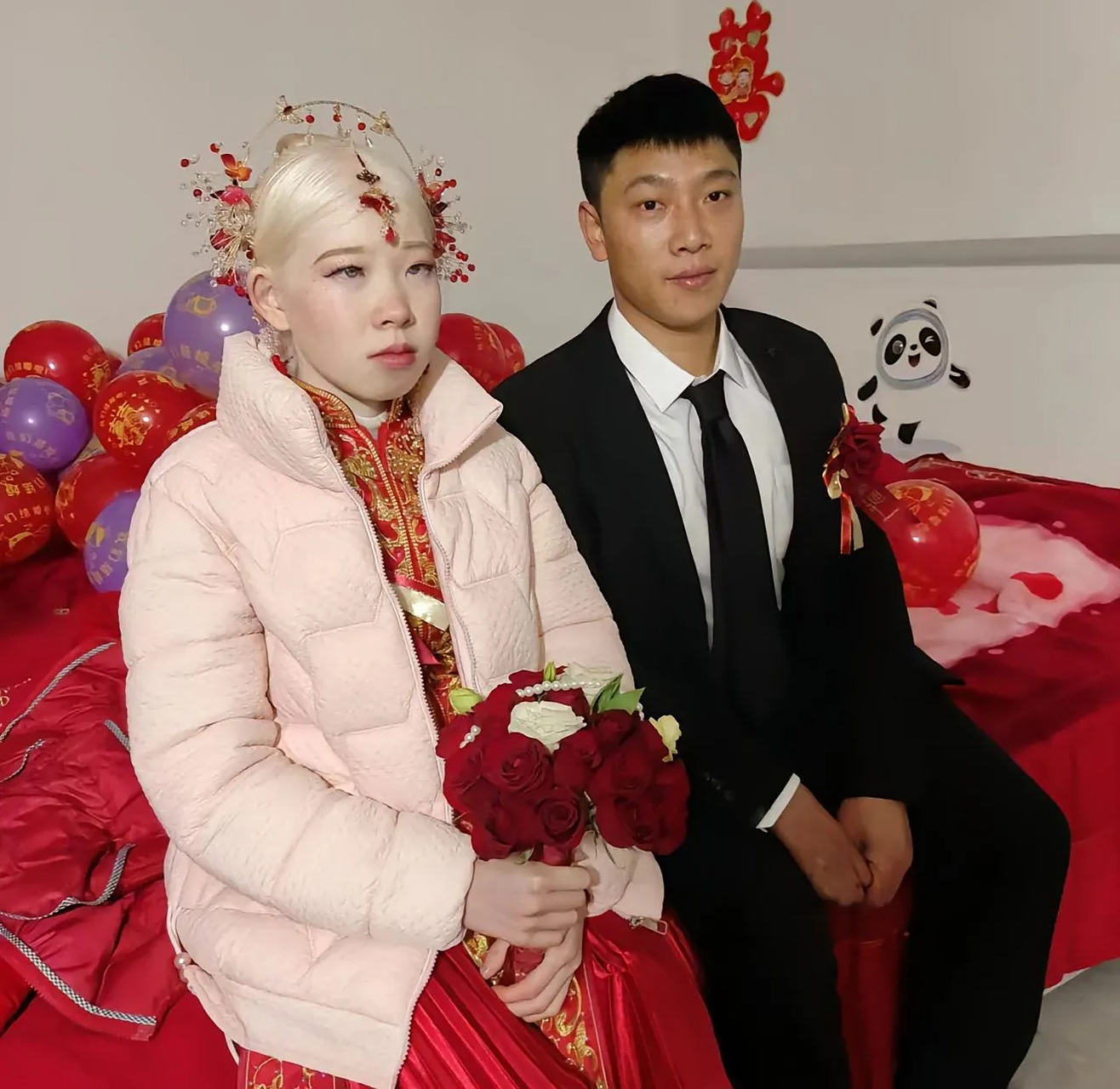 姐妹自小先天性白化病,一直没能找到合适的婆家,毕竟谁也不想找个得病