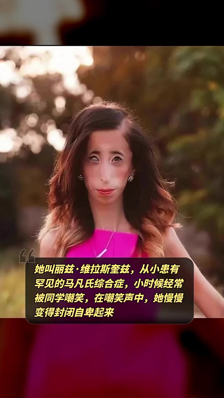 2006年,美国,一名17岁的女孩长相奇丑,却散发着自已独有