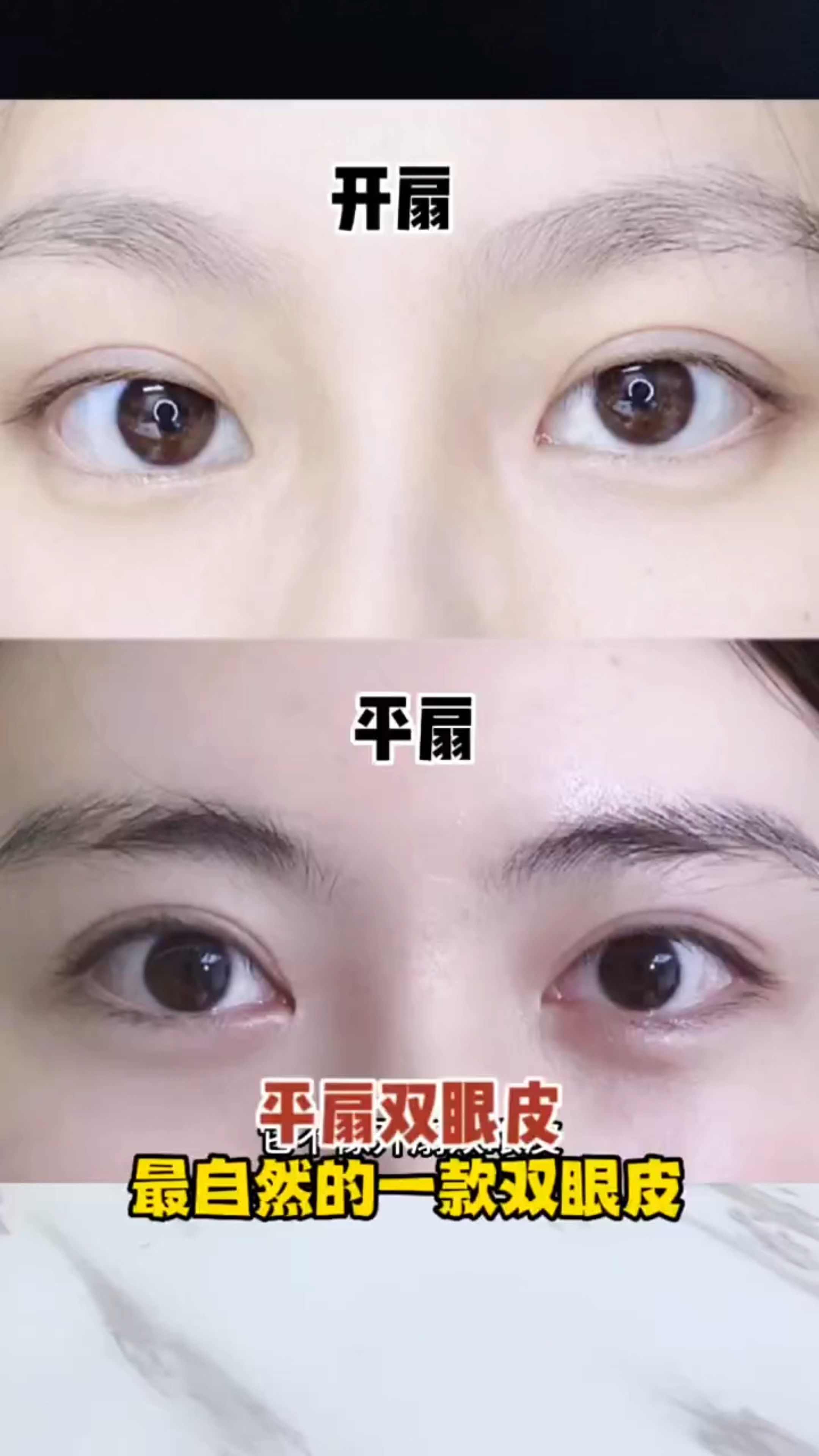平扇双眼皮最自然的一款双眼皮
