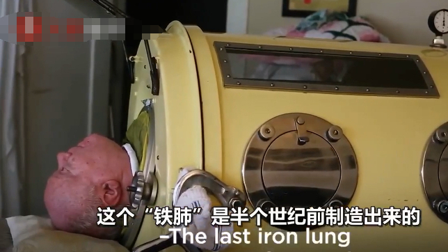 回顾断电就会死在铁桶里躺71年他是感动世界的最后一个铁肺人