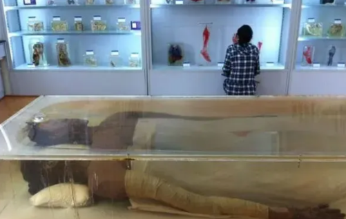 2005年,湖南湘雅医学院,中国"第一女巨人"曾金莲的遗体被安放在标本室