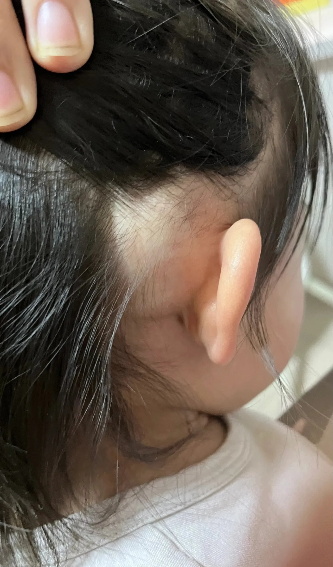 宝宝头上突然出现了一个大包!