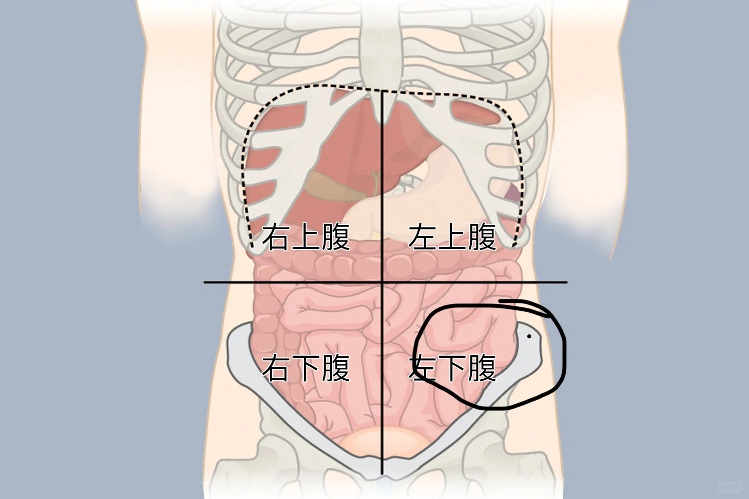 子宫肌瘤小腹变大图片图片