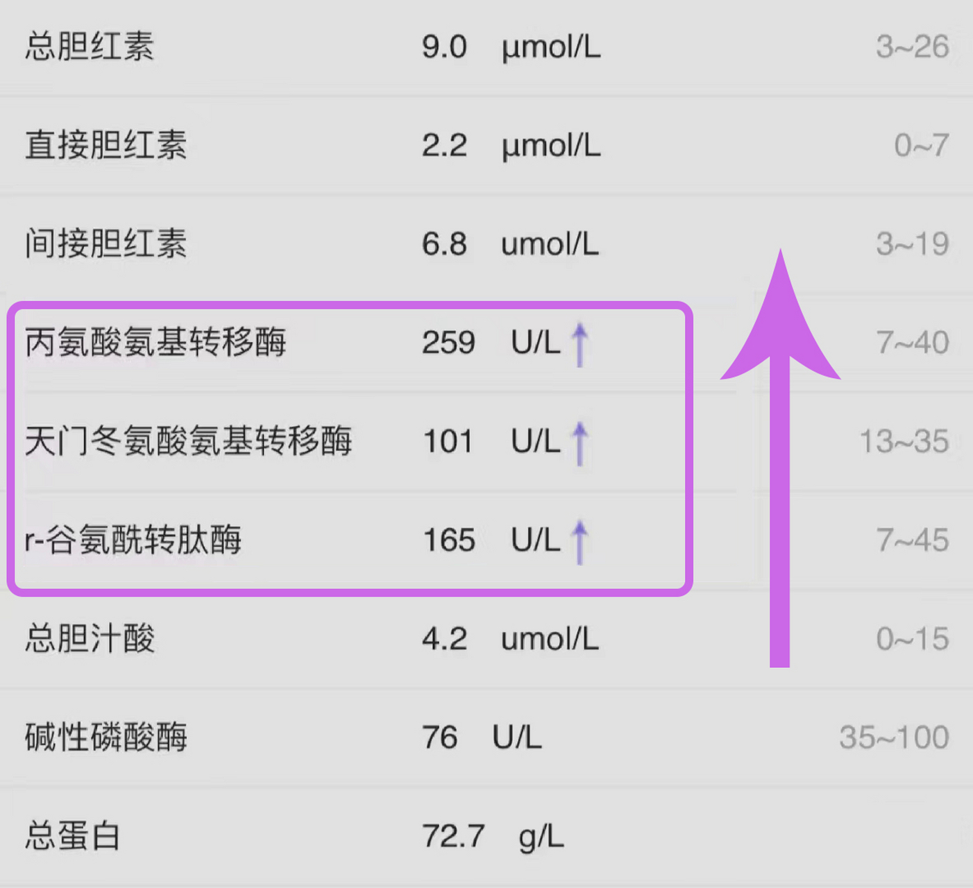 肝功能检查中警惕血清肝酶的异常.