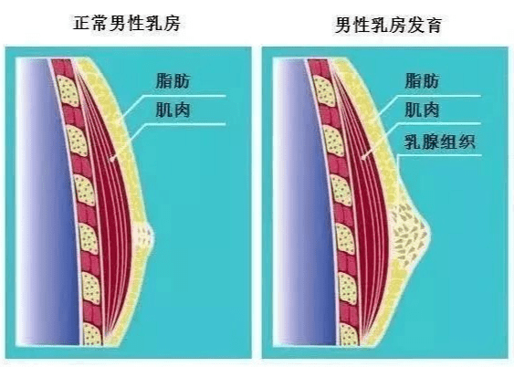 男性乳腺结构图片