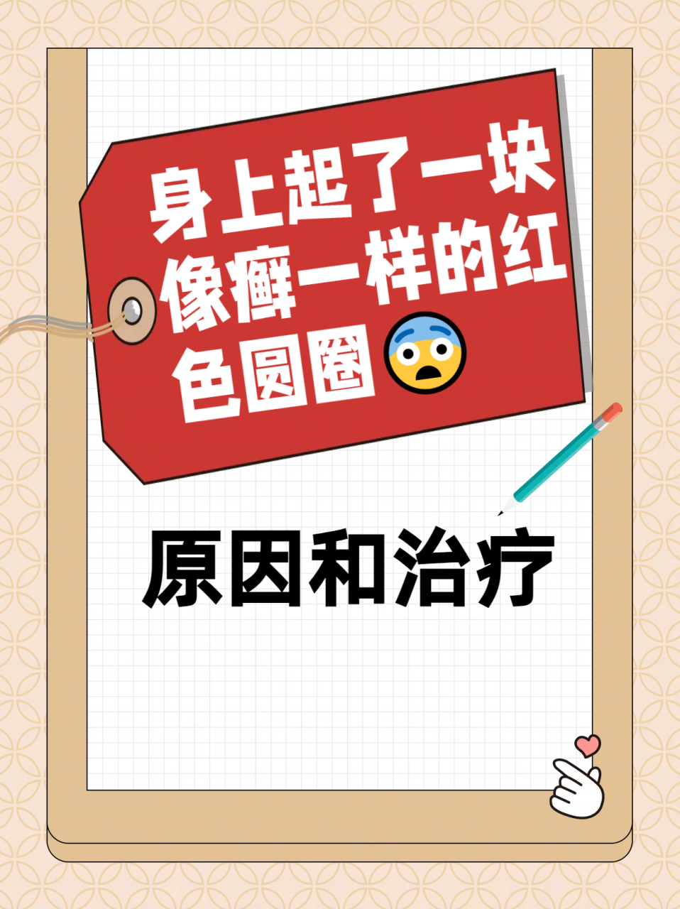 身上起了一块像癣一样的红色圆圈06原因和治疗  05早上起来发现