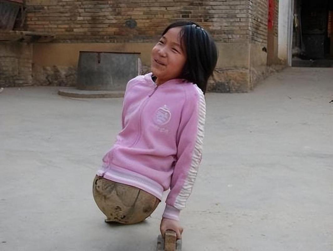 23年前那个失去双腿,靠半个篮球走路的4岁女孩,今替国出征残奥