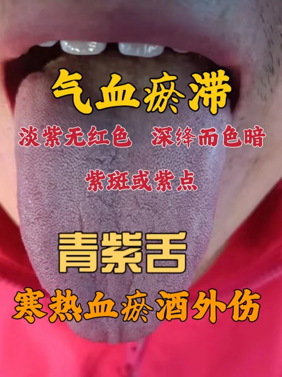 通过舌头的颜色,可以初步判断是气,血,阴,阳,寒,热等哪方面的疾病.