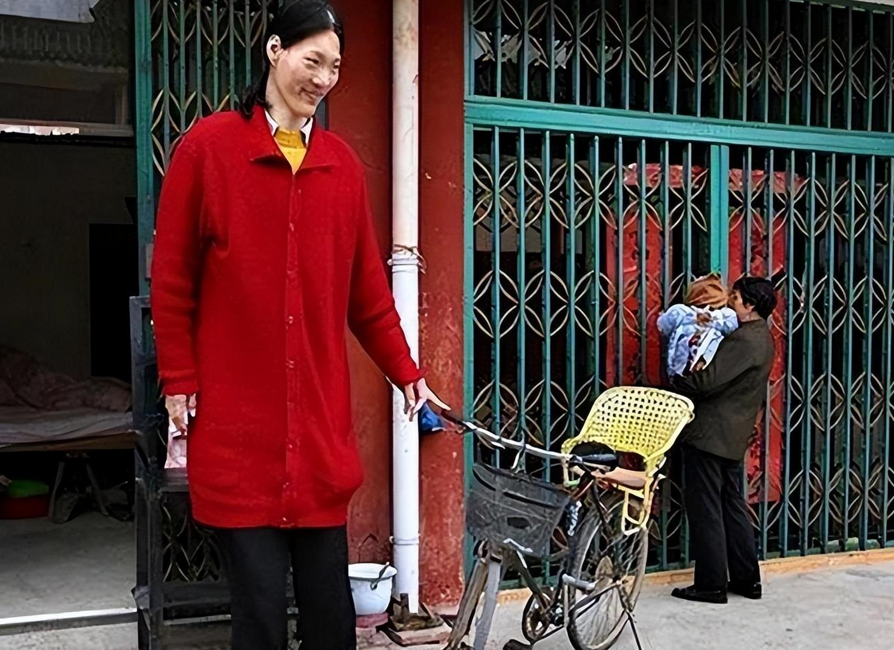 女巨人症图片