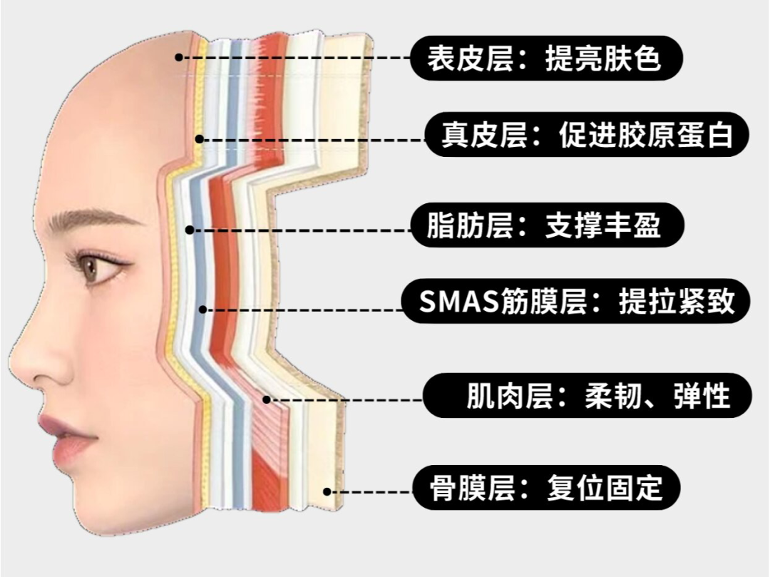 那些做过超声炮韧带提升的人,脸都怎么样了?