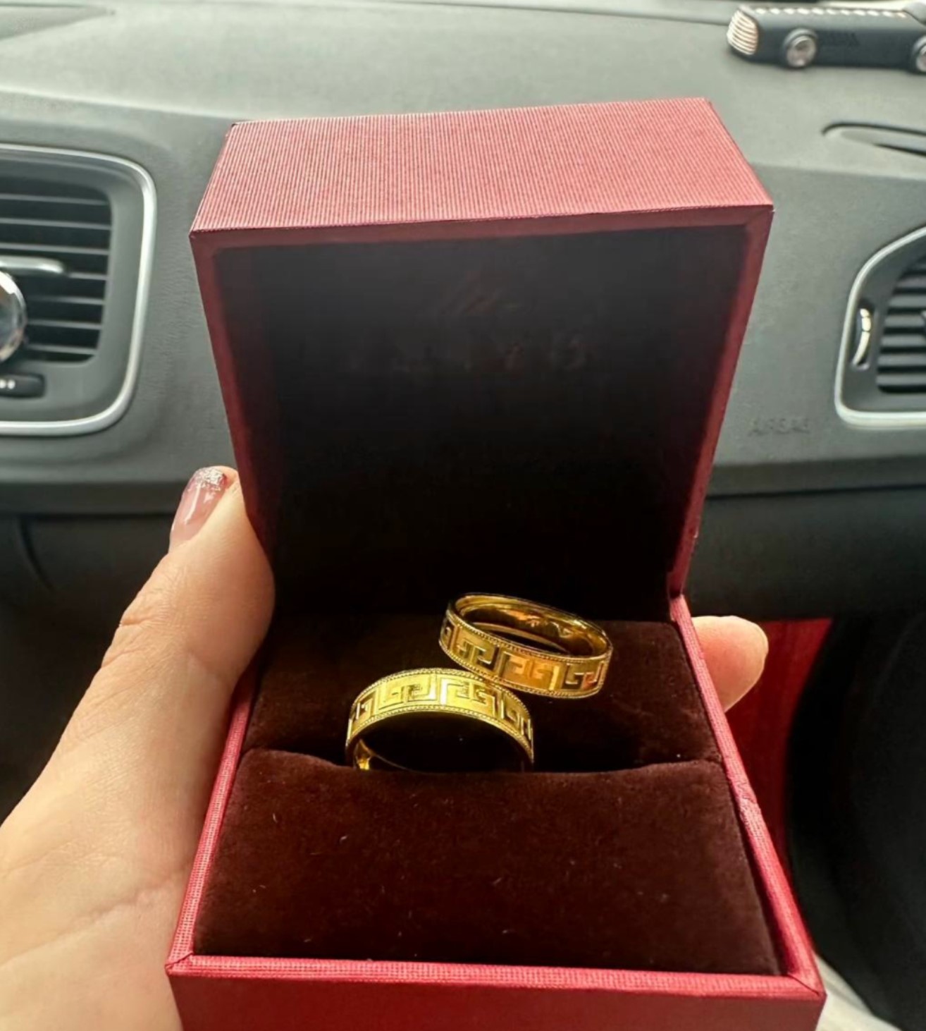 威海一女子发现金戒指褪色竟救自己一命，原因与水银珠有关