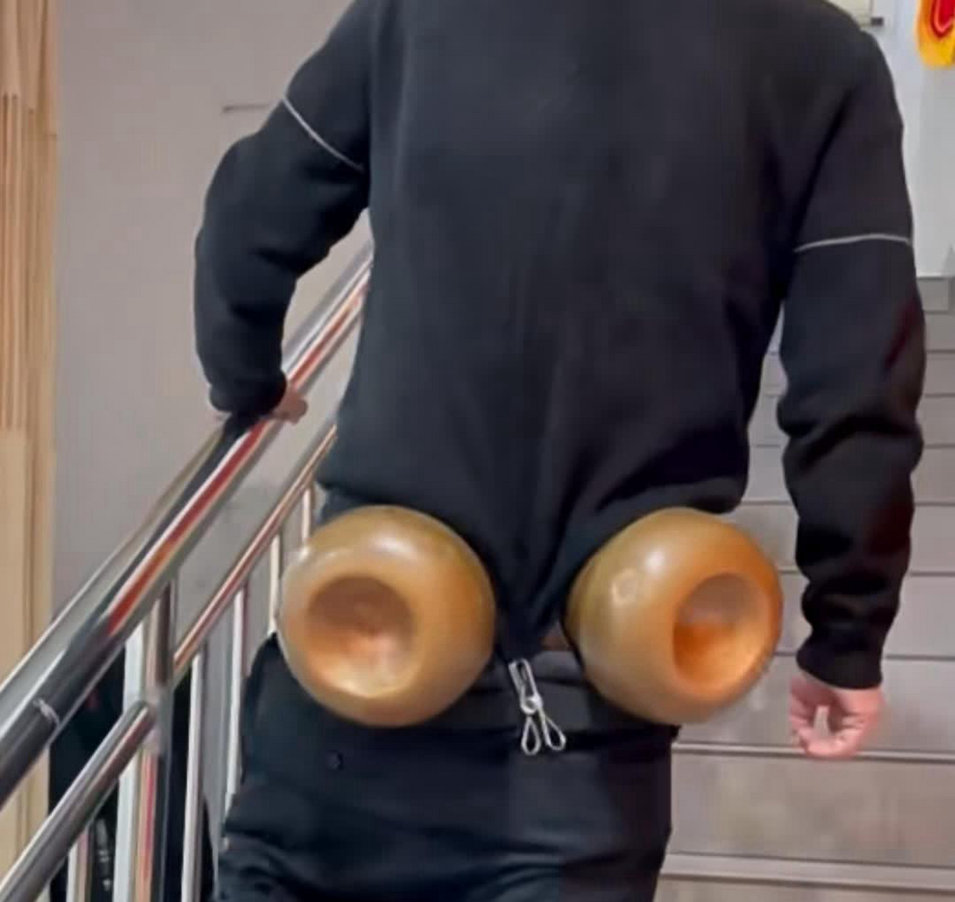 在臀部进行拔罐治疗,真是令人忍俊不禁.