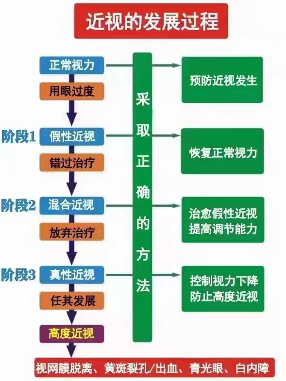 近视的发展过程:从假性到真性,再到高度近视与眼部疾病