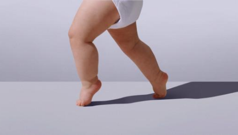 在婴幼儿时期,尖足也可能是正常的生理现象,因为婴幼儿的足部肌肉尚未