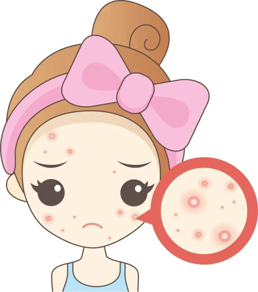 「热点消息」脸上痘痘红肿硬块怎么消退?