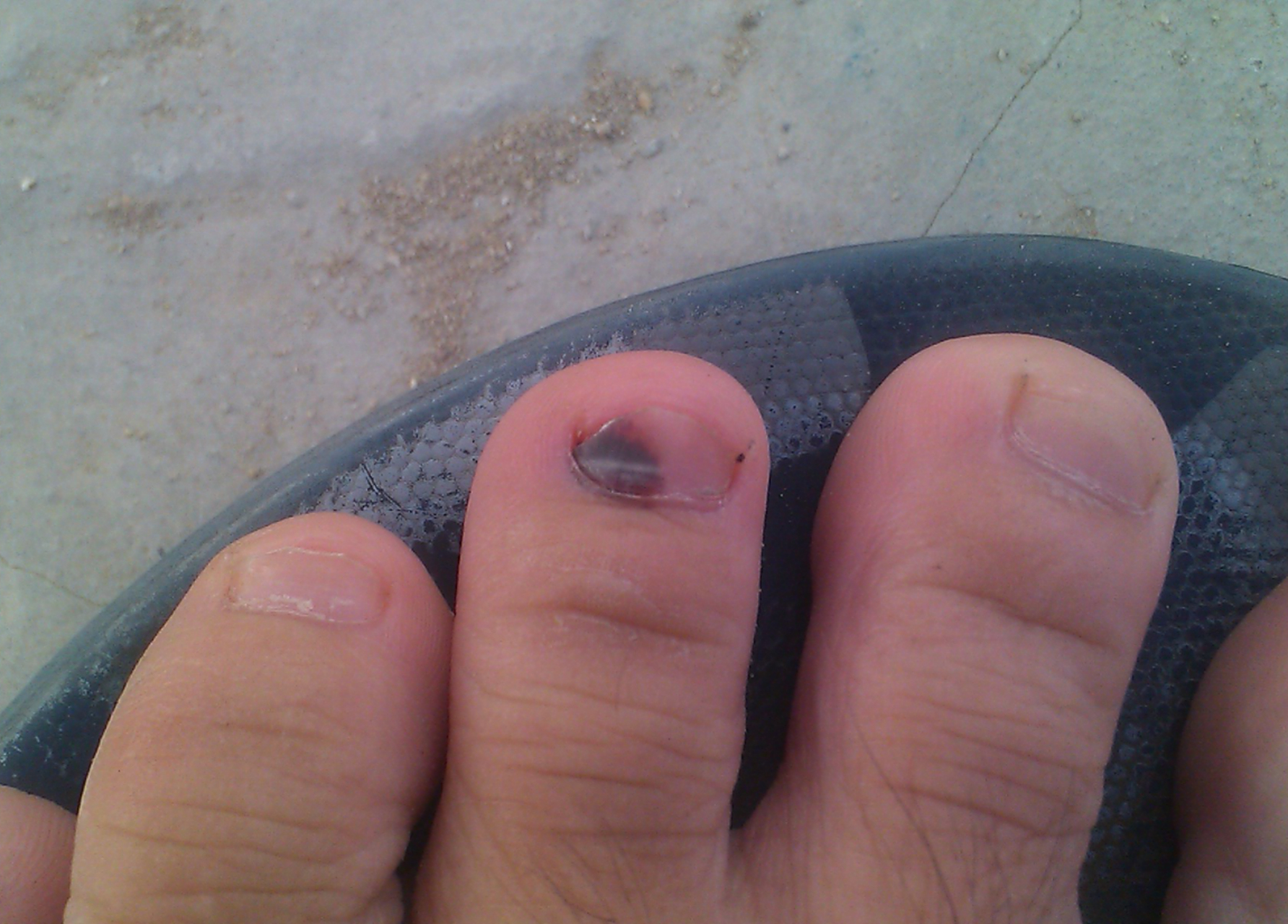 脚上若有这4个特征,可能是癌细胞偷偷找上门来,早了解早受益!