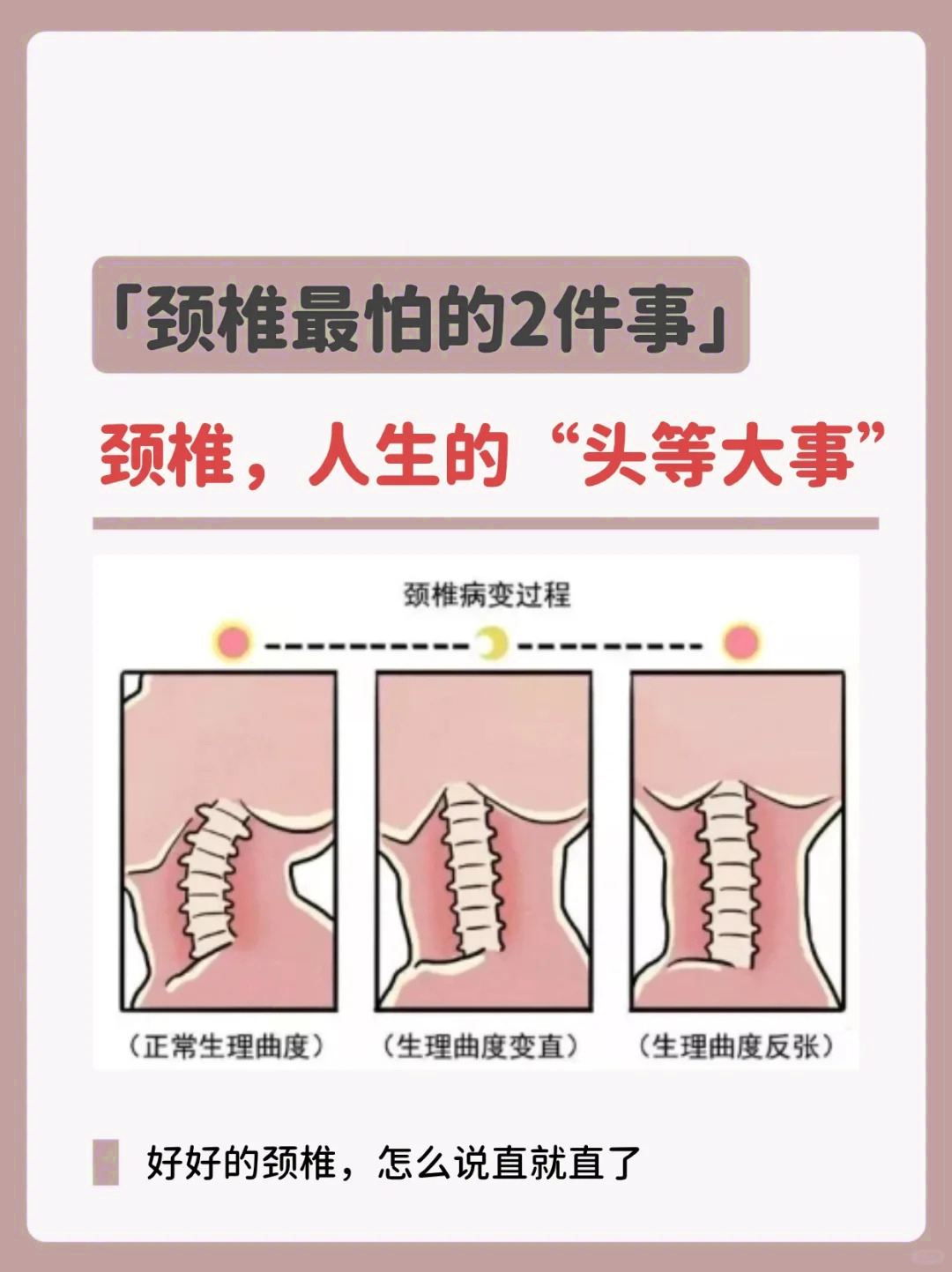 颈椎和肩椎的位置图片图片