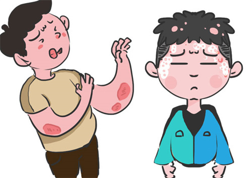 牛皮癣是一种常见的皮肤病,需要进行一系列检查以确诊和治疗.