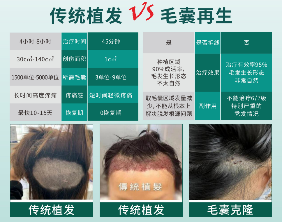 植发选择时间(植发什么时候便宜)