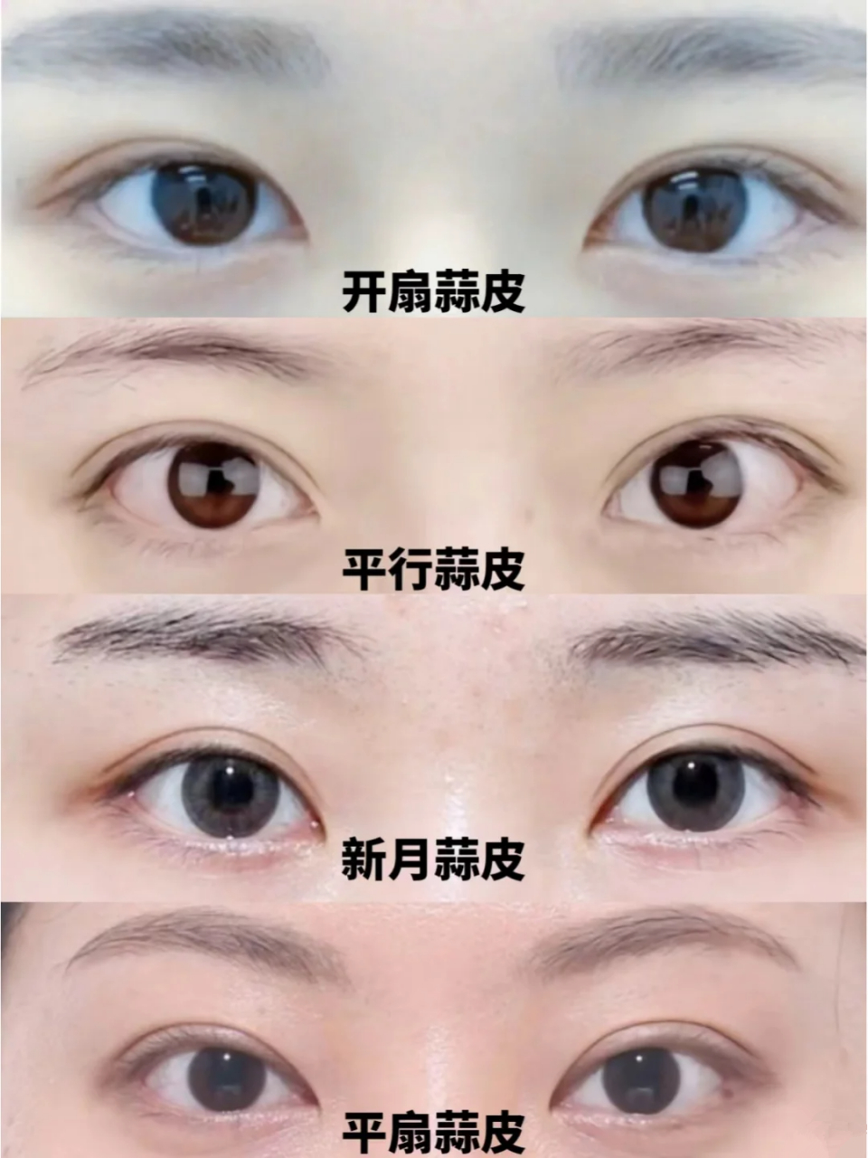 4种双眼皮模板 开扇:自然妈生,看上去眼睛圆,显年轻 平扇:自然,灵动
