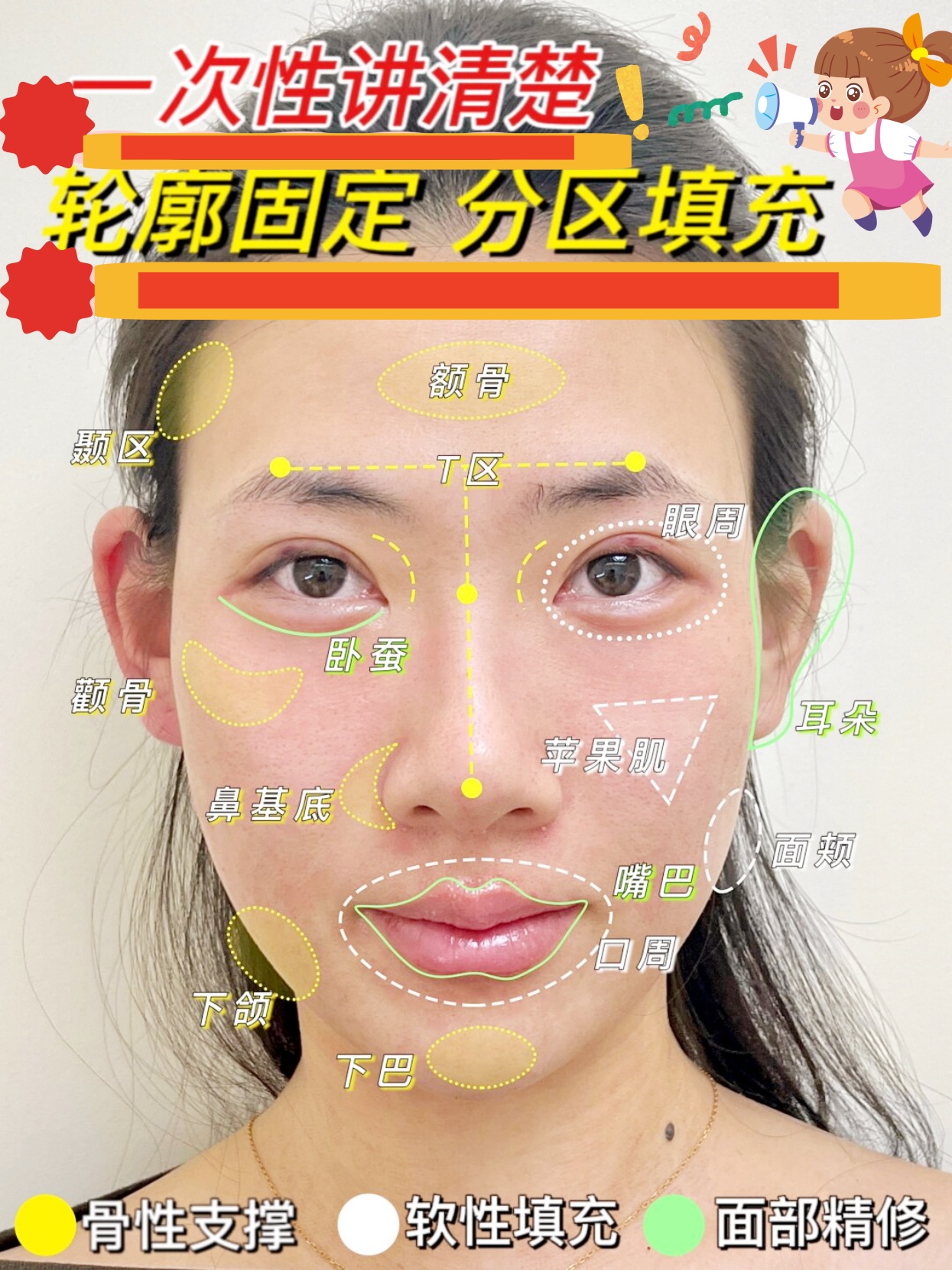 一次性讲清楚 轮廓固定分区填充