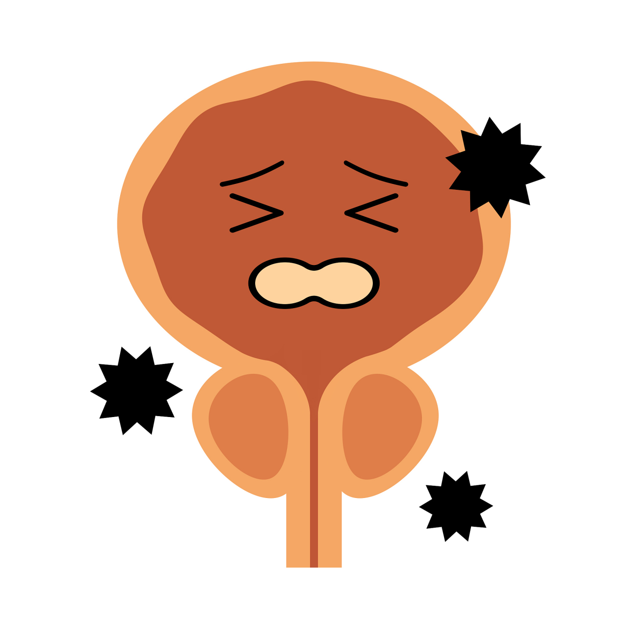 膀胱炎是由细菌感染引起的膀胱炎症,常见症状包括尿频,尿急,尿痛等.