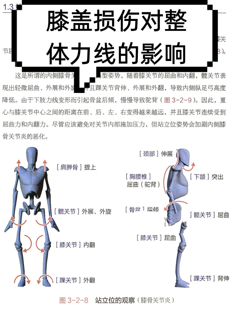 膝盖损伤对整体力线的影响