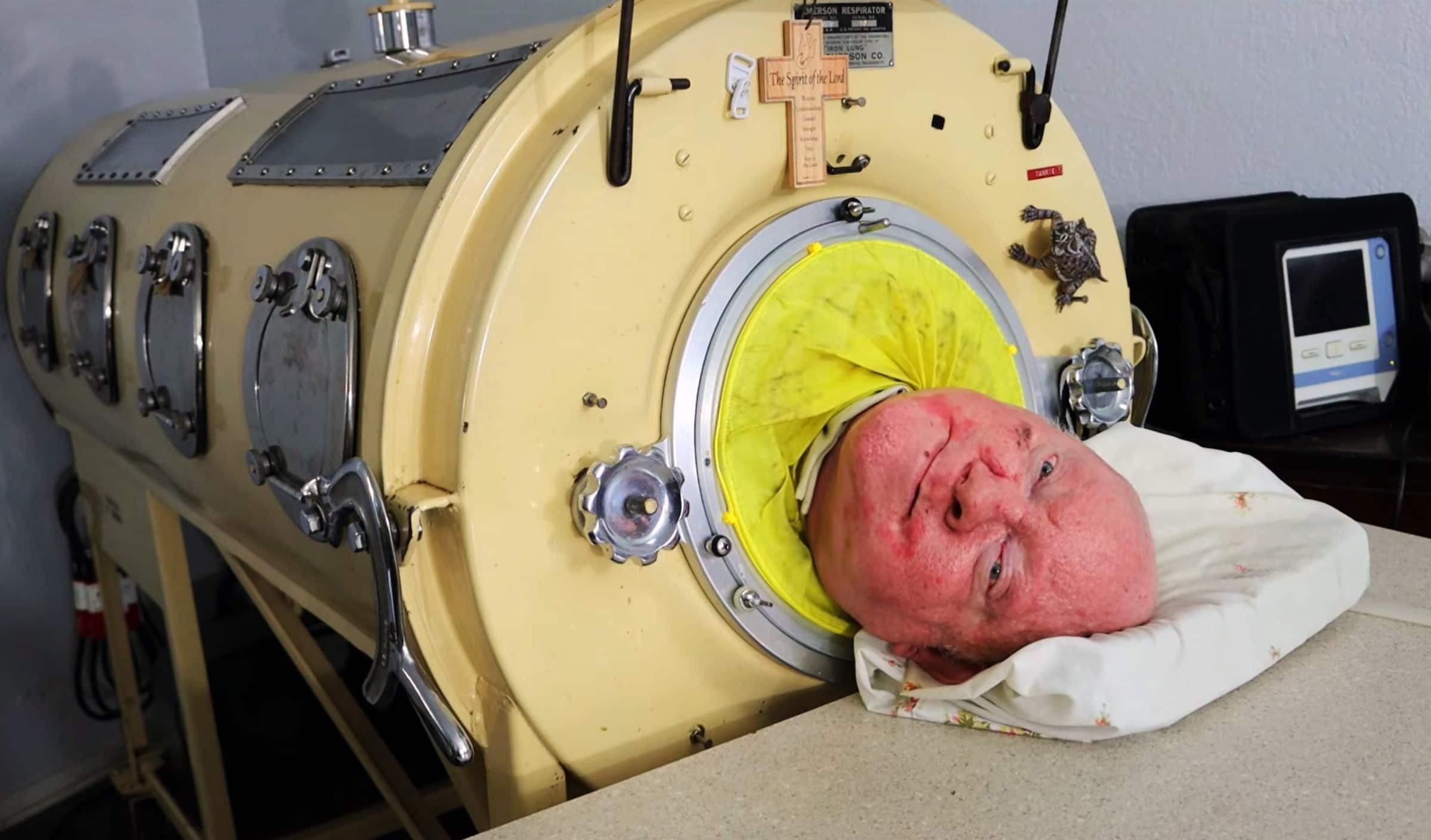 一生无法自主呼吸,被困"铁桶"69年的铁肺人,停电就意味着死亡