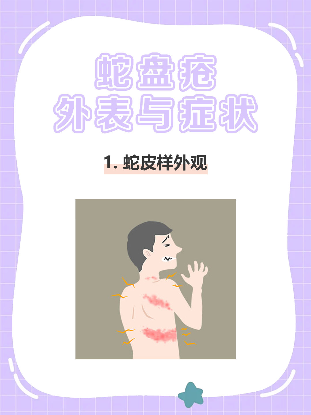 科普:蛇盘疮外表与症状