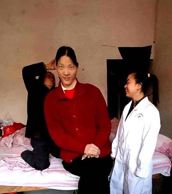 中国巨人症患者图片