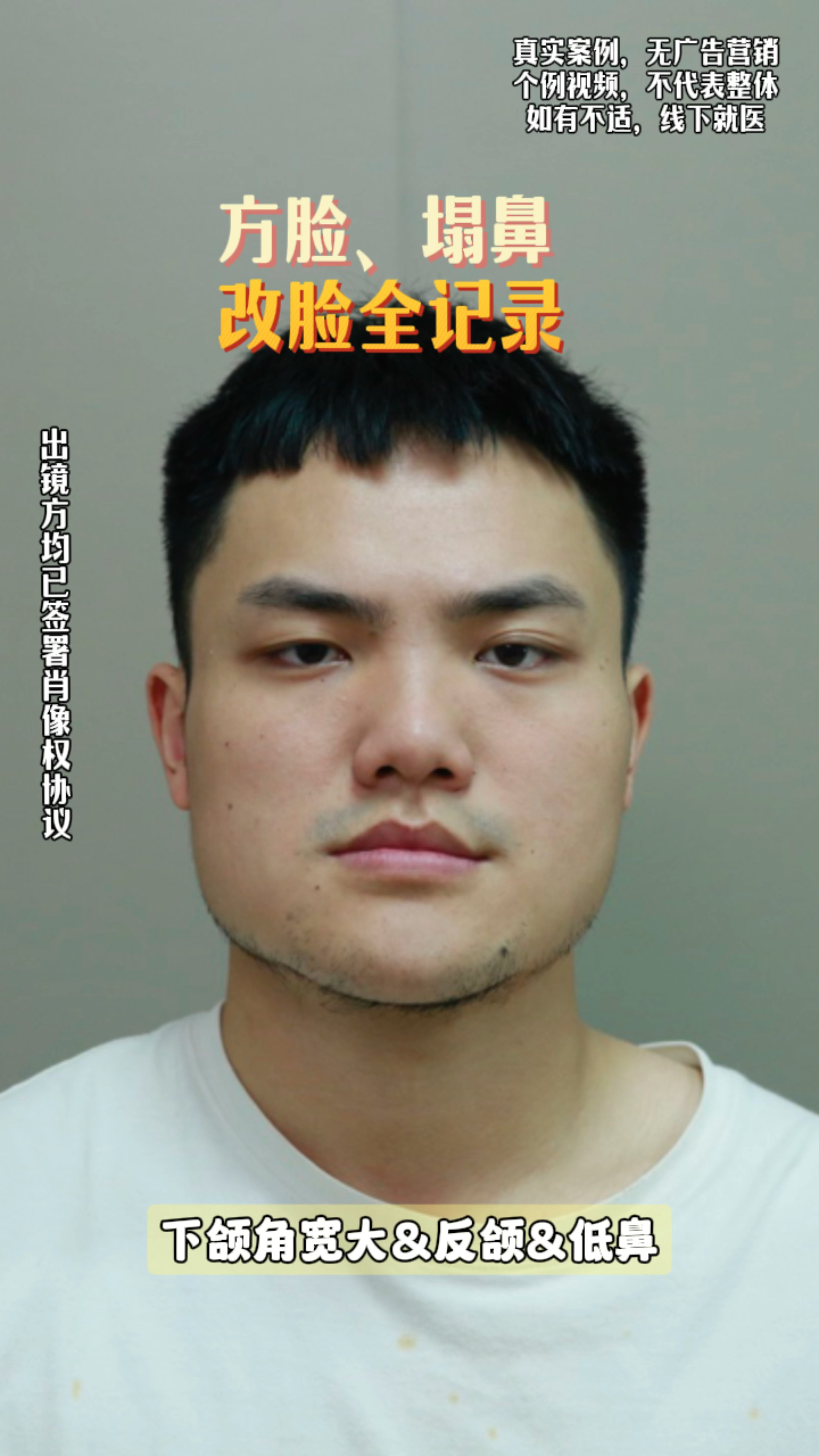 "国字脸"变阳刚男,他到底做了什么?