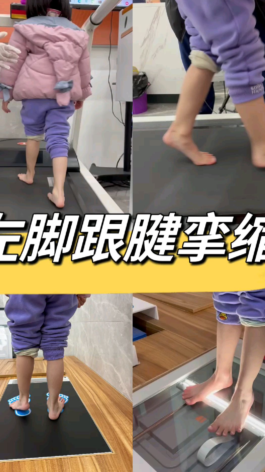 小女孩左脚骨折后出现跟腱挛缩,跛脚走路进行步态测评