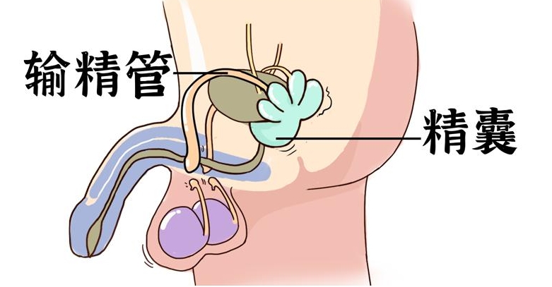 输精管炎是由于感染引起的一种疾病,男性一旦这个器官出现炎症就会